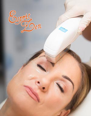 HIFU | Esprit Zen — Le Lifting sans Chirurgie